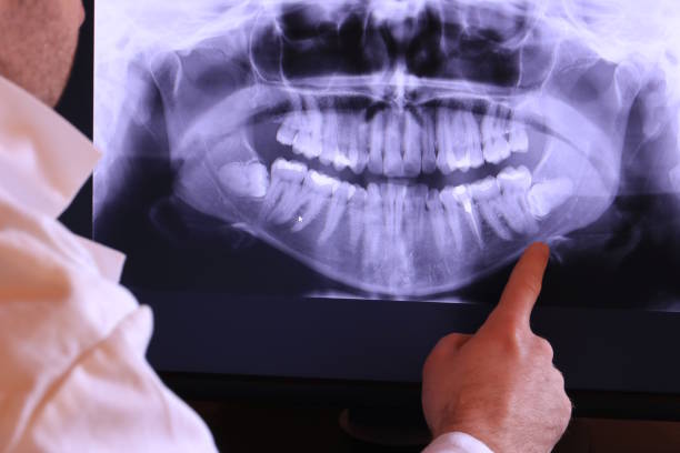 Best Emergency Treatment for Oral Infections in Upton, WY