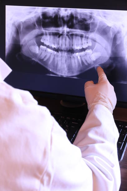 Best Emergency Cosmetic Dentistry (e.g., broken veneers) in Upton, WY