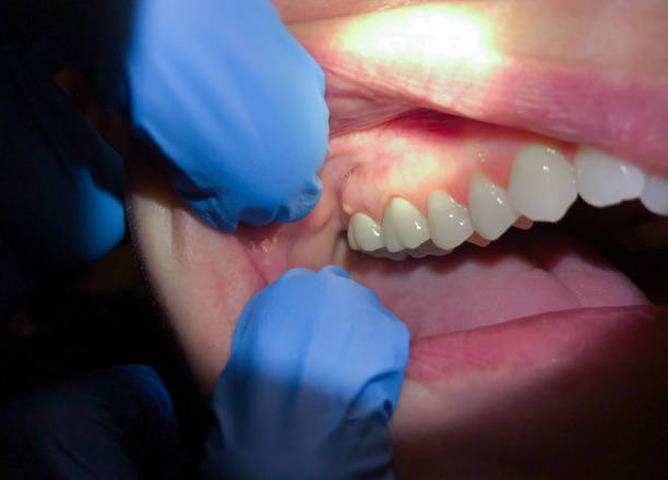 Best 24-Hour Emergency Dental Care in Upton, WY